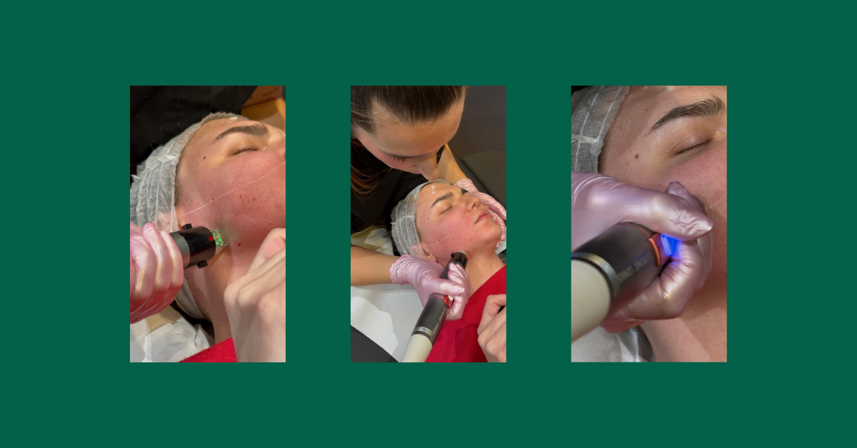 postupak Genius tretmana