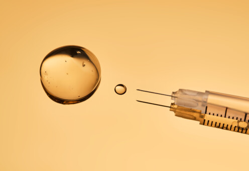 mezoterapija lica kada ići na tretman